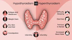 Hyperthyroidism and Hypothyroidism Image