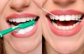 brushing and flossing image