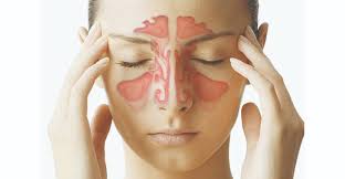 nasal congestion images