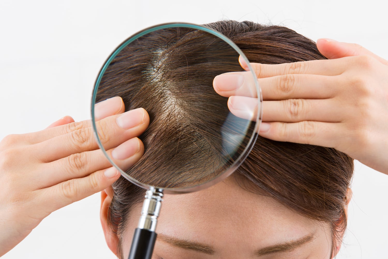 Blood circulation in scalp image