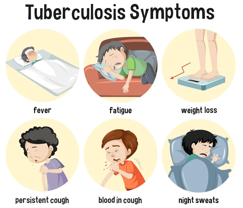 Tuberculosis